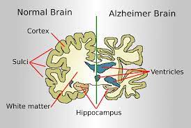 info-image