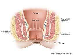 info-image