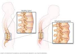 info-image