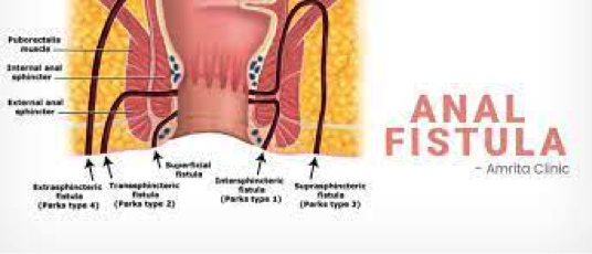 info-image