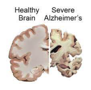 info-image