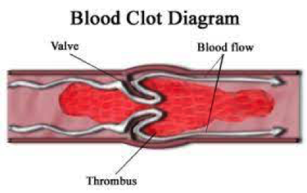 info-image