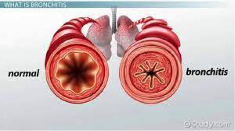 info-image