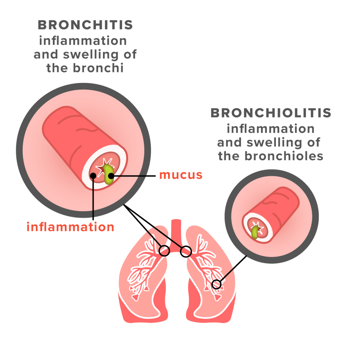 info-image