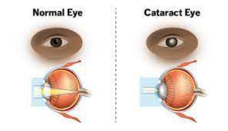 info-image