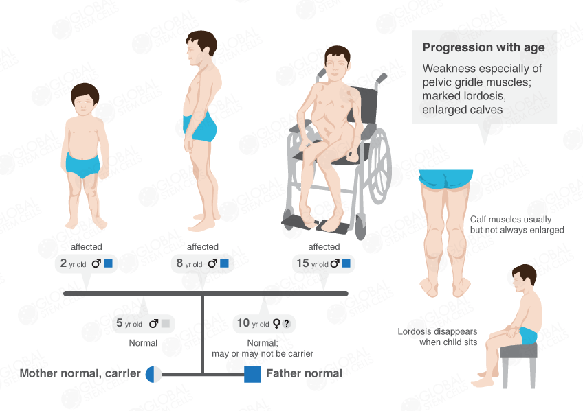 info-image