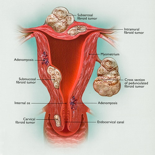 info-image