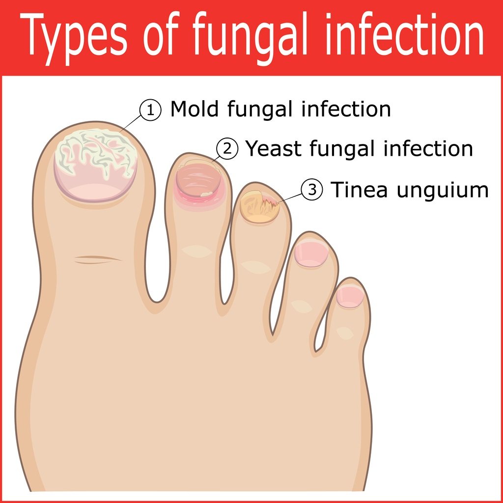 info-image