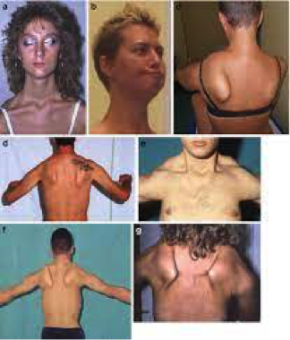 info-image