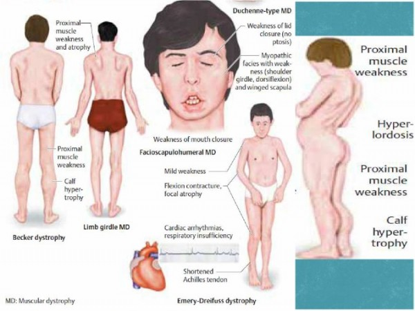 info-image