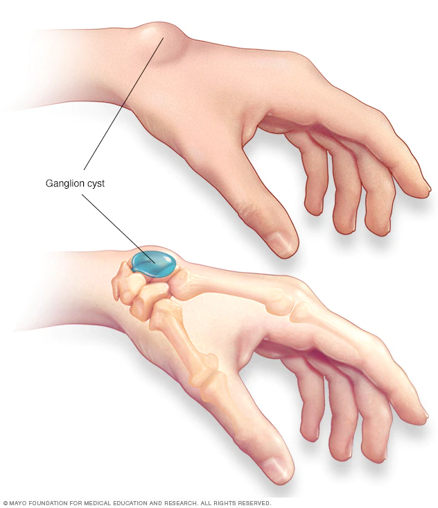 info-image