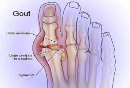 info-image
