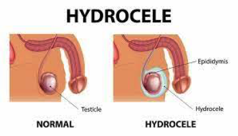 info-image