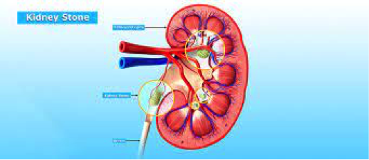 info-image