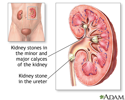 info-image