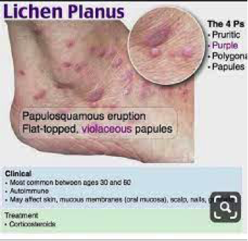 info-image
