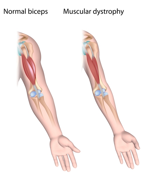 info-image