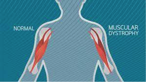info-image