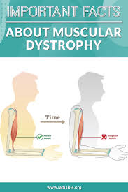info-image