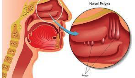 info-image