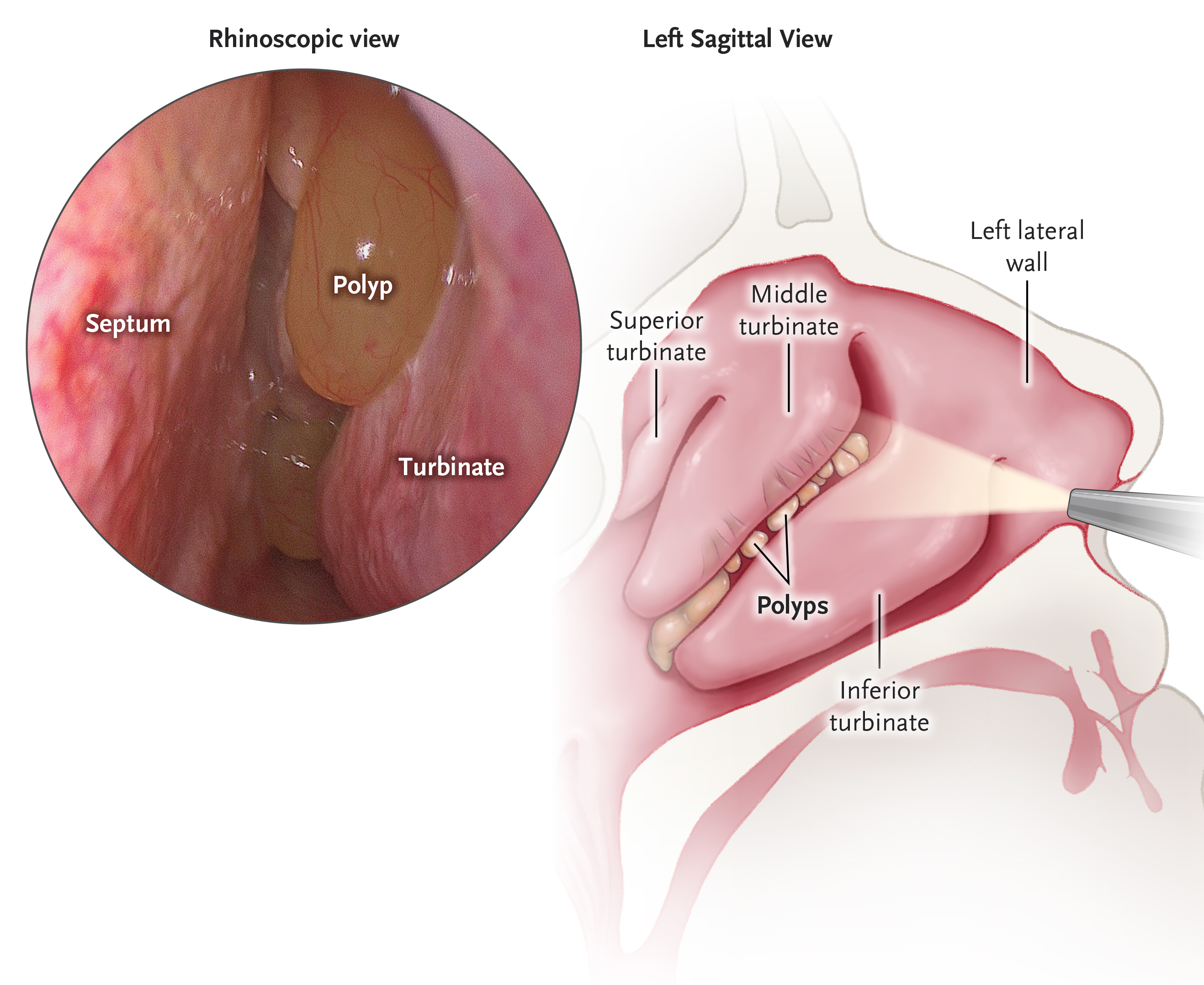 info-image