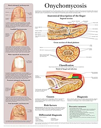info-image