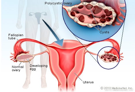 info-image