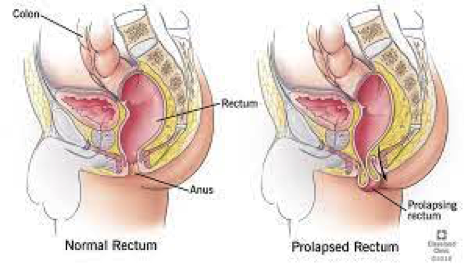 info-image