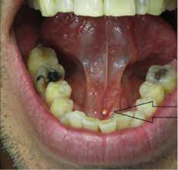 info-image
