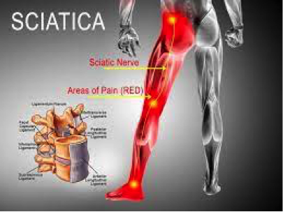 info-image