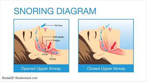 info-image