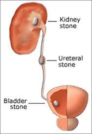 info-image