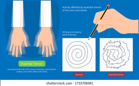 info-image