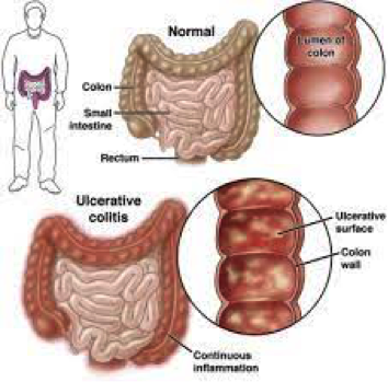 info-image
