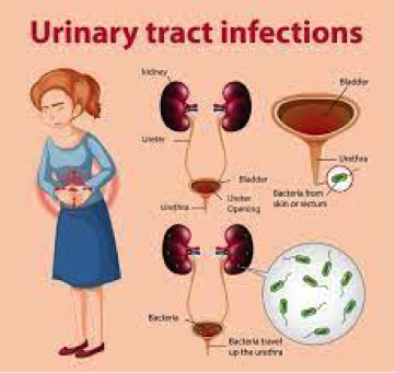 info-image
