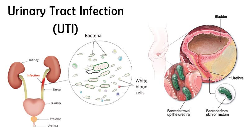 info-image