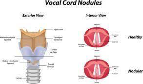 info-image
