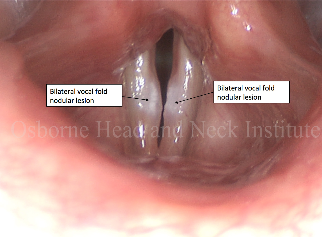 info-image