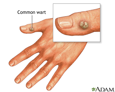 info-image